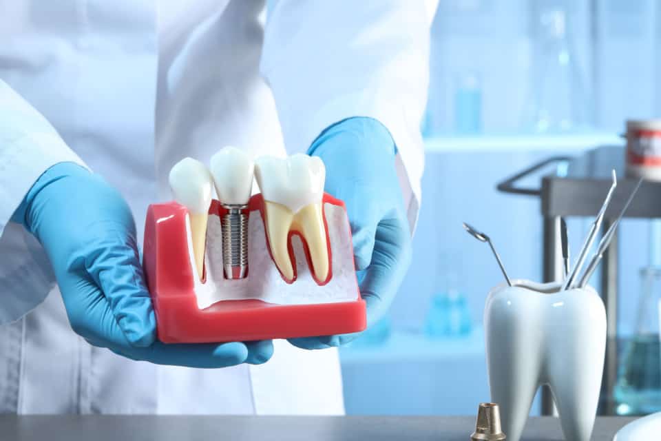 Restorative Dentistry - Dental Implants