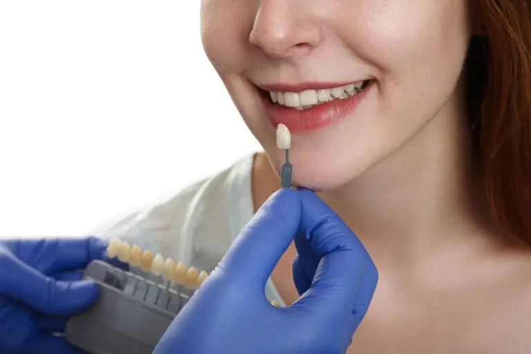 Dentist comparing tooth shades for porcelain veneers during cosmetic dental treatment for a natural smile.
