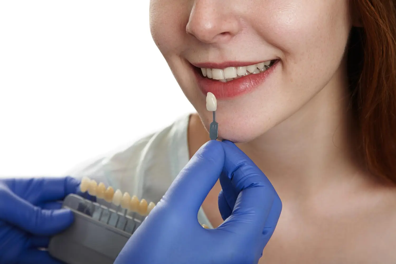 Dentist comparing tooth shades for porcelain veneers during cosmetic dental treatment for a natural smile.
