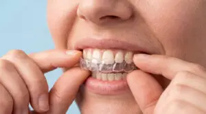 Patient wearing clear aligners for Invisalign treatment to straighten teeth with discreet cosmetic dental treatment use.