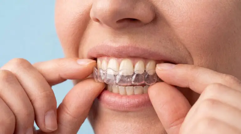 Patient wearing clear aligners for Invisalign treatment to straighten teeth with discreet cosmetic dental treatment use.